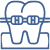 braces vect